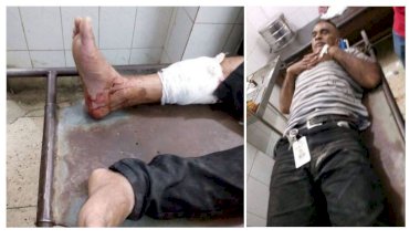 সিআইডি কর্মকর্তাকে হাতুড়ি পেটা